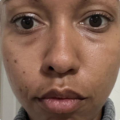 Day 1