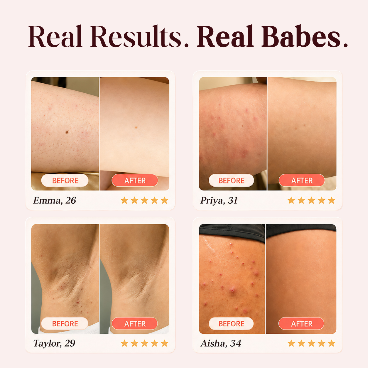 Peachie™ V2 - Your Bikini Line’s New Bestie.
