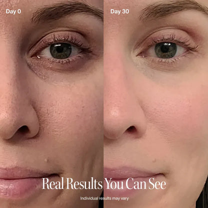 Peachie™ GlowLift