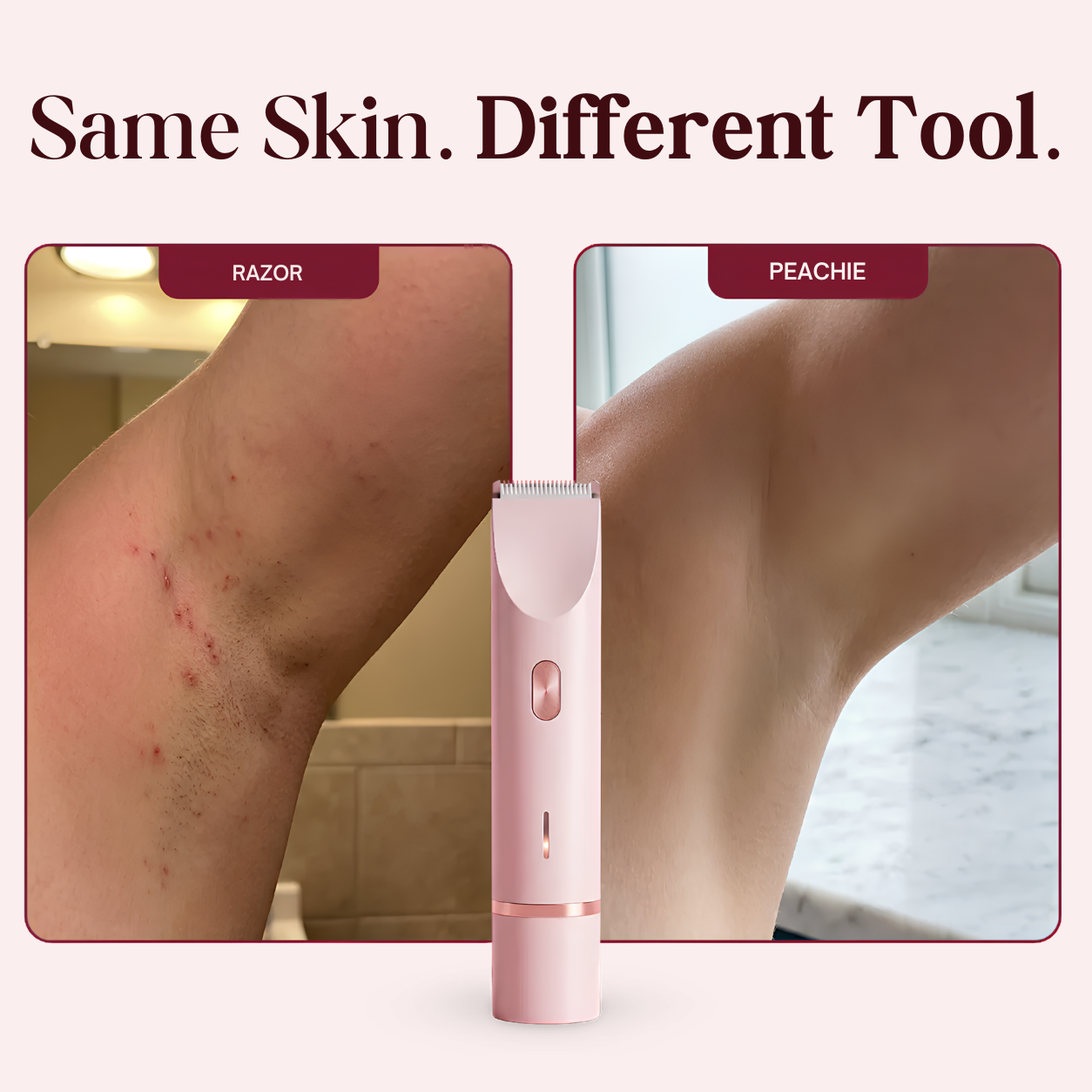 Peachie™ V2 - Your Bikini Line’s New Bestie.